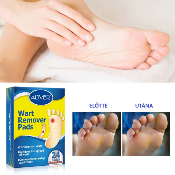 Wellife Szemölcstapasz 24 db